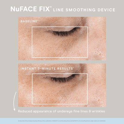 DISCONTINUED - NuFACE FIX® Starter Kit | NuFACE